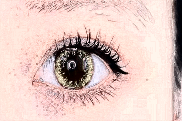 吉林市中心醫(yī)院做雙眼皮多少錢?做雙眼皮好嗎