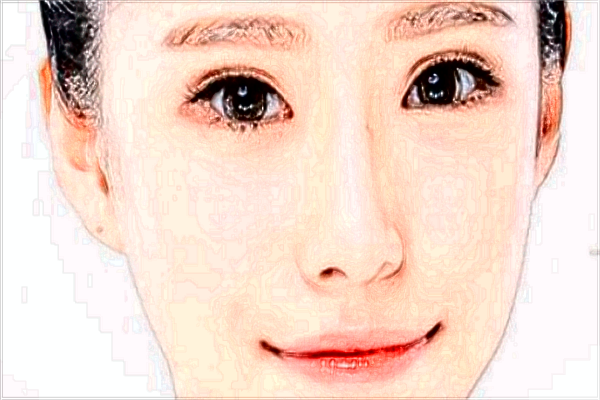 保定去眼袋哪家醫(yī)院好【去眼袋案例】