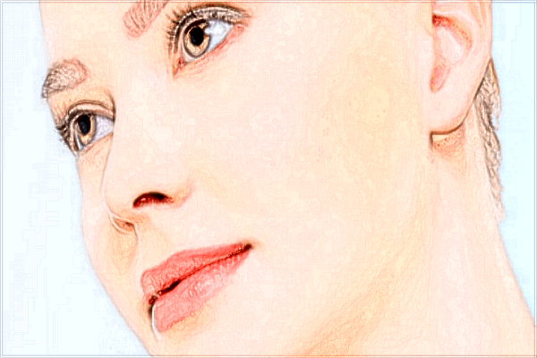 廣州海峽拉皮可以祛除法令紋嗎?拉皮價格貴嗎?