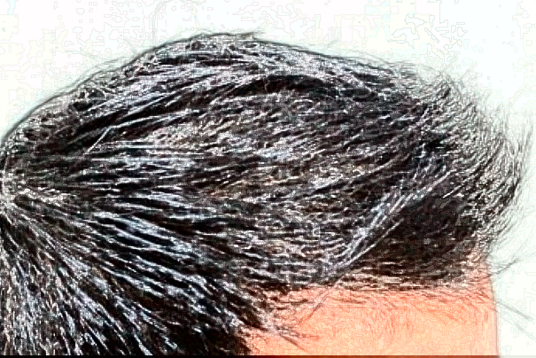 北京麗都植發(fā)怎么樣_醫(yī)生名單