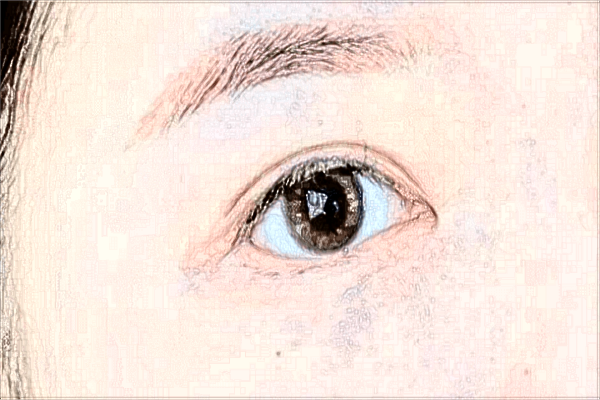 2024浙江醫(yī)院切開雙眼皮價(jià)格表(價(jià)目表)一覽