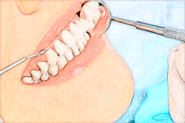 2024浙江醫(yī)院種牙價格?單顆牙種植的費用