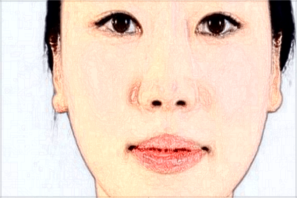 2024做手術(shù)價目表(價格表)怎么樣