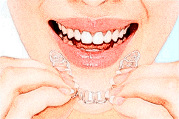 2024重慶解放軍324醫(yī)院口腔科牙齒美白怎么樣_牙齒美白對(duì)牙齒有傷害嗎