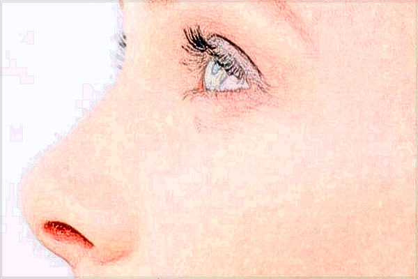 北京麗都做雙眼皮怎么樣?2024北京麗都做雙眼皮價(jià)格表