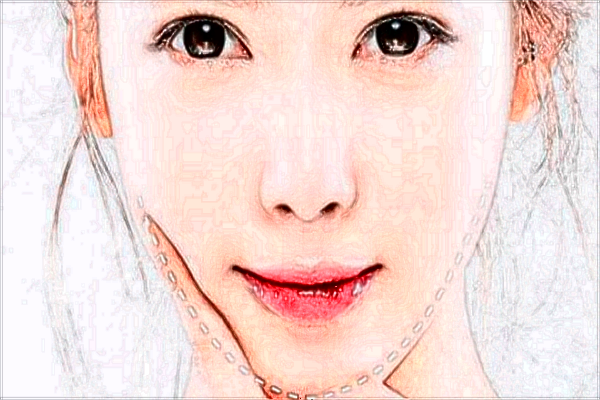 玻尿酸豐面頰會下垂嗎?玻尿酸豐面頰會僵硬嘛?