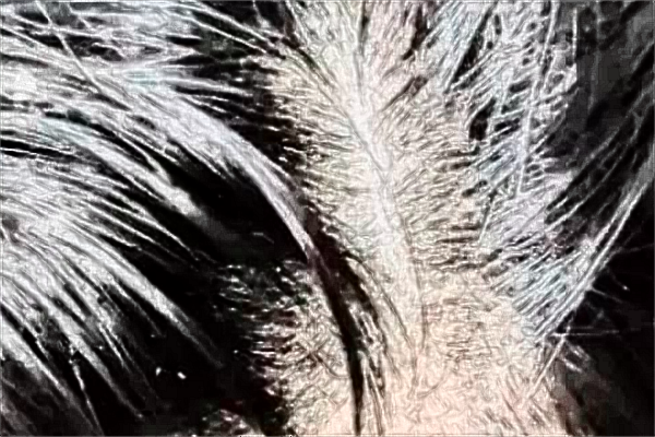 上海植發(fā)醫(yī)院哪家技術(shù)好_植發(fā)多少錢