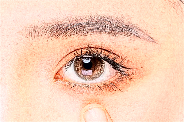 北京麗都去黑眼圈哪個醫(yī)生好_去黑眼圈價格表