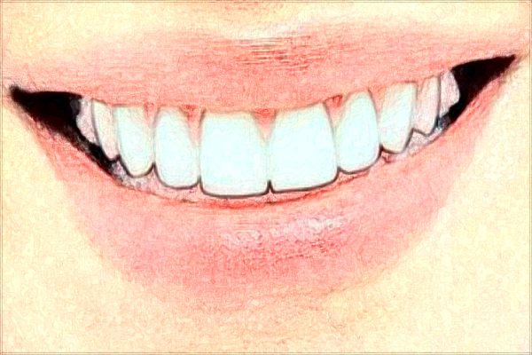 交大二院植牙怎么樣_植牙和鑲牙哪個(gè)對身體更好