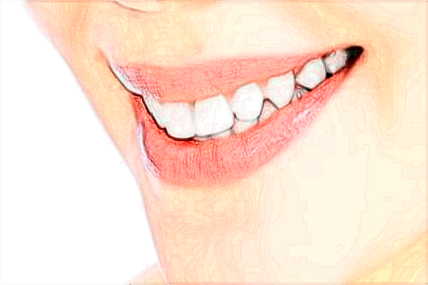 交大二院植牙怎么樣_植牙和鑲牙哪個(gè)對身體更好