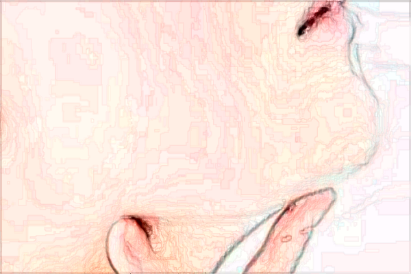 北京潤美玉之光去雙下巴哪個(gè)醫(yī)生好_怎么樣