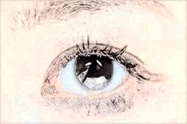 北京二院2024做雙眼皮價格?做雙眼皮哪個醫(yī)生好