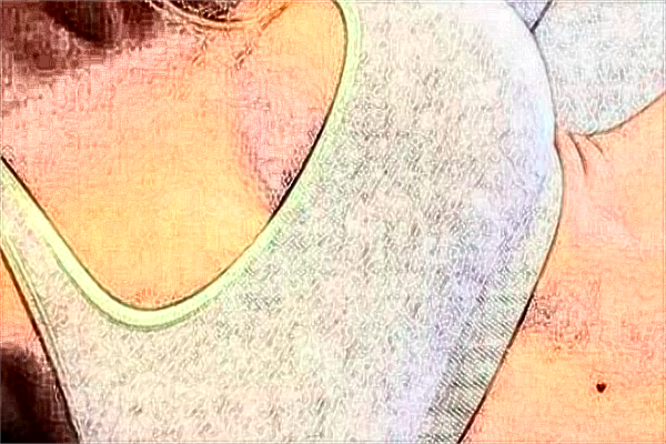 貴陽中醫(yī)學(xué)院二附院脂肪填充怎么樣_醫(yī)生技術(shù)怎么樣