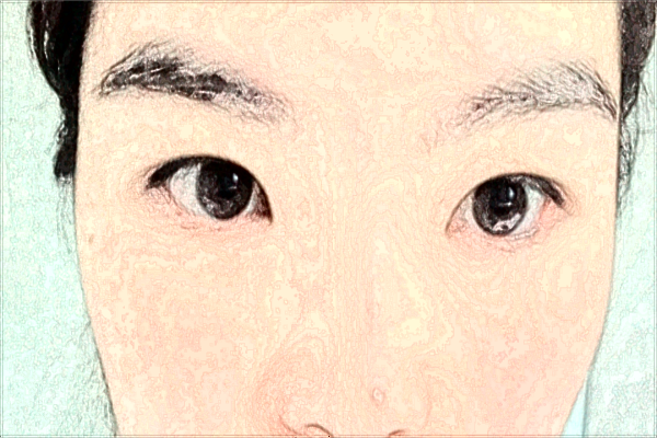 2024北京潤美玉之光硅膠隆鼻價(jià)格表_硅膠隆鼻可以維持多少年