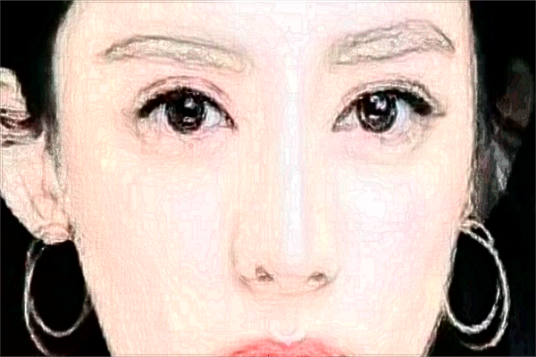 北京潤美玉之光去眼袋怎么樣_哪位醫(yī)生技術(shù)好