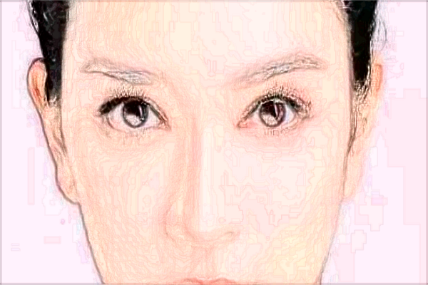 北京潤美玉之光去眼袋怎么樣_哪位醫(yī)生技術(shù)好