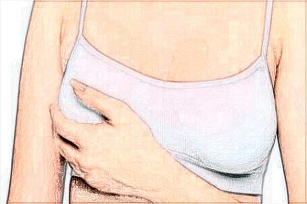 2024浙二院自體脂肪隆胸多少錢(qián)_自體脂肪隆胸有什么危害