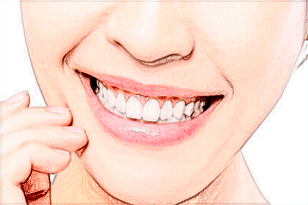 北京大學(xué)口腔醫(yī)院種植牙價(jià)格表_種植牙需要住院嗎