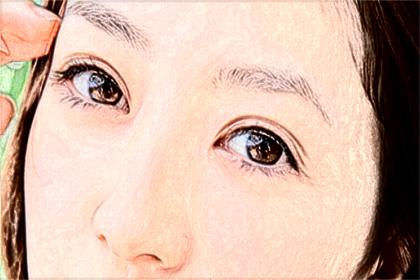 玻尿酸豐面頰打一次合適嗎?玻尿酸豐面頰會發(fā)炎嗎?