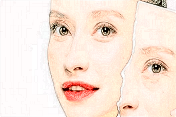 常熟二院光子嫩膚怎么樣?2024光子嫩膚價格一覽表