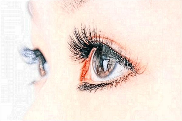 淮安二院做眼袋技術(shù)好不好?附做眼袋案例