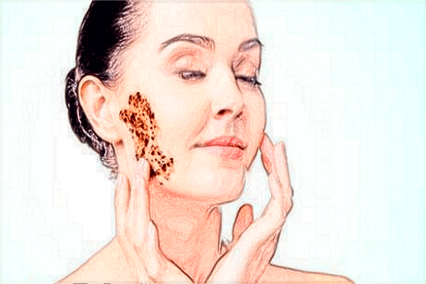 膨體隆鼻和硅膠的區(qū)別?膨體隆鼻和硅膠隆鼻哪個更?