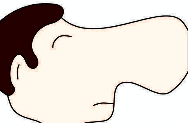 膨體隆鼻會變細變窄嗎?膨體隆鼻會回縮多少呢?