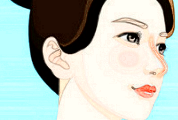 膨體隆鼻需要墊鼻尖嗎?膨體隆鼻需要恢復(fù)多久可以自然?