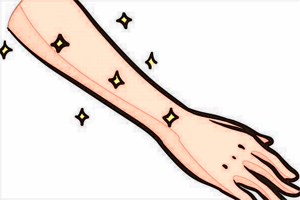 2024成都華西醫(yī)院激光脫毛怎么樣【激光脫毛案例】