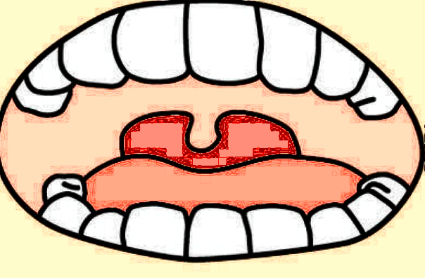 廈門大學(xué)附屬中山醫(yī)院矯正牙齒怎么樣?矯正牙齒多少錢