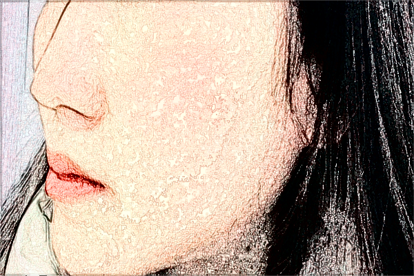 2024四川省人民醫(yī)院熱瑪吉怎么樣_哪些醫(yī)生技術(shù)比較好