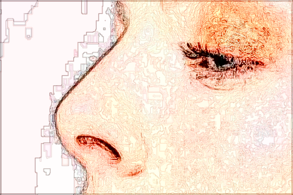 2024四川省人民醫(yī)院隆鼻哪個醫(yī)生好【隆鼻案例】