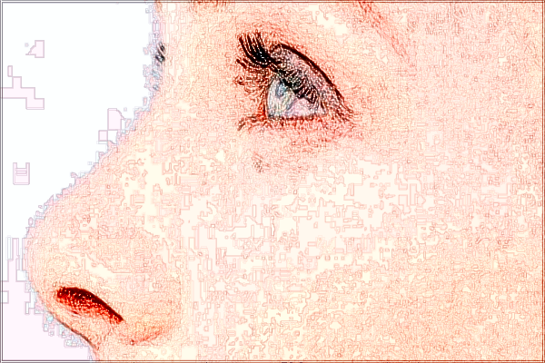 2024四川省人民醫(yī)院隆鼻哪個醫(yī)生好【隆鼻案例】