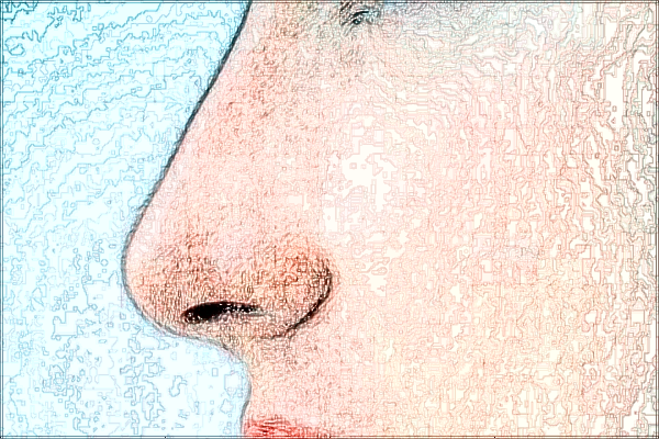 四川省人民醫(yī)院去胎記價目表(價格表)怎么樣