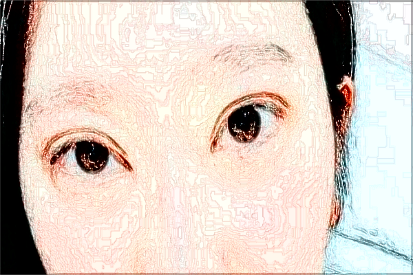 四川省人民醫(yī)院去胎記價目表(價格表)怎么樣