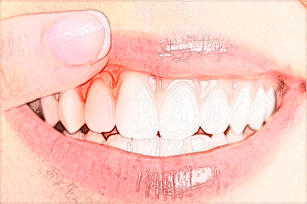 四川省人民醫(yī)院種植牙怎么收費(fèi)_哪位醫(yī)生做的比較好