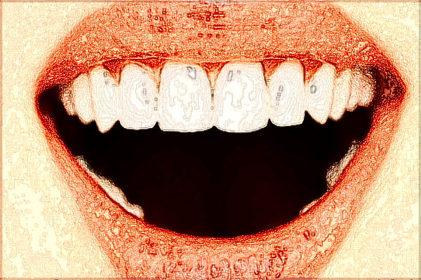 2024四川省人民醫(yī)院烤瓷牙怎么收費(fèi)_醫(yī)生推薦