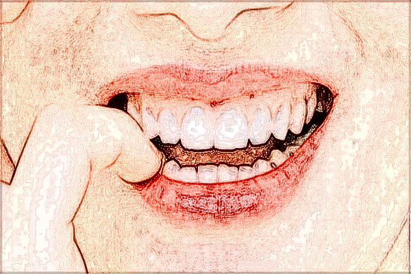 2024四川省人民醫(yī)院隱形矯正牙齒費(fèi)用_醫(yī)生名單