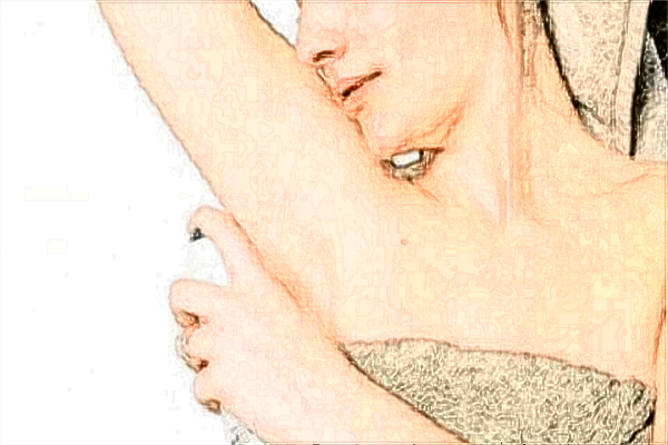 2024四川省人民醫(yī)院微創(chuàng)狐臭要多少錢【做狐臭案例】