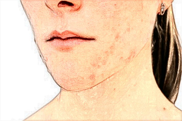 2024威海市立二院豐下巴價(jià)格_玻尿酸豐下巴注意事項(xiàng)