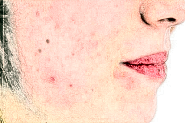 2024威海市立二院自體脂肪填充面部價(jià)格怎么樣