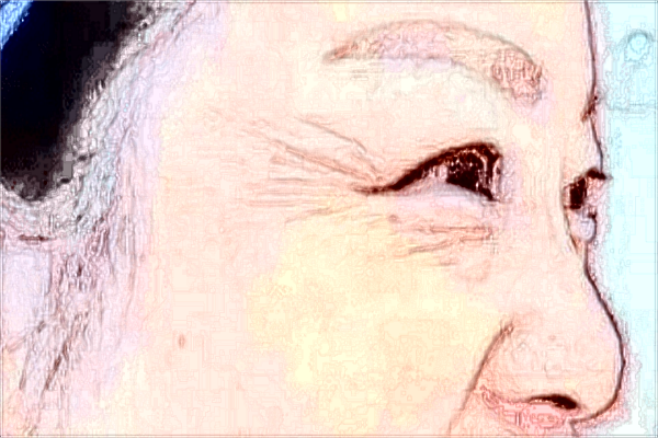 2024威海市立二院自體脂肪填充面部價(jià)格怎么樣