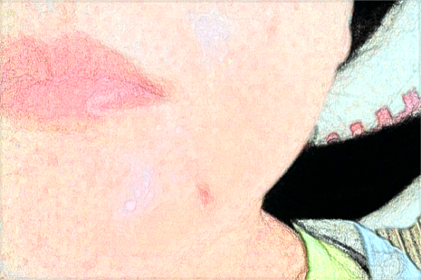 自體脂肪豐面頰多少錢?自體脂肪豐面頰多久可以做第二次?