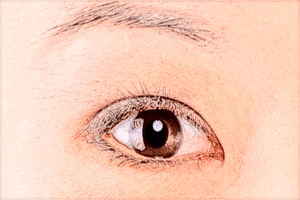 成都格萊麗口碑好不好?醫(yī)生拉雙眼皮費用2024