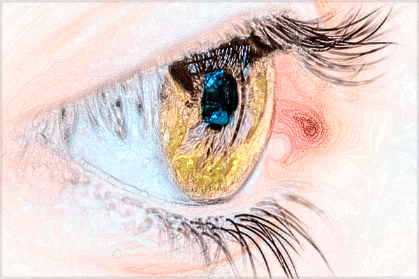 2024成都格萊麗做雙眼皮價(jià)格?醫(yī)生雙眼皮案例