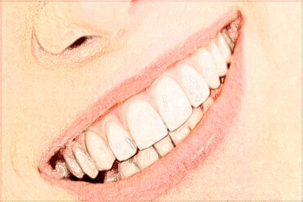 上海華山醫(yī)院烤瓷牙案例_附醫(yī)生名單推薦