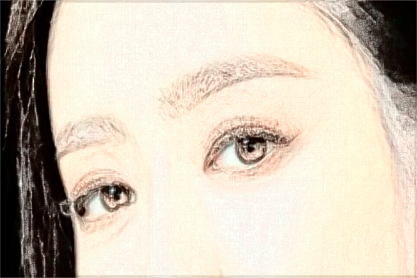 上海華山醫(yī)院玻尿酸除皺需要多少費(fèi)用|怎么樣