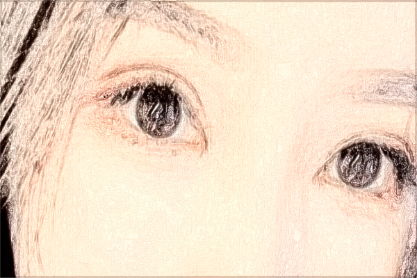 上海華山醫(yī)院光子嫩膚需要多少費(fèi)用_做的好的醫(yī)生有哪些