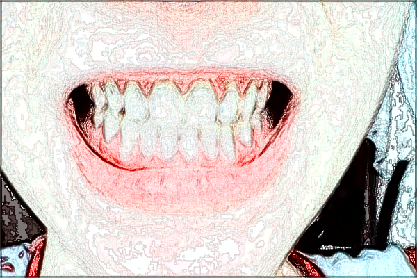 淮北市人民醫(yī)院種植牙價目表(價格表)十一月上新