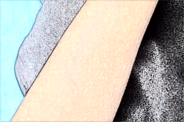 南京市中醫(yī)院激光脫毛哪位醫(yī)生做的好_收費貴不貴